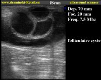 iscan-10.jpg